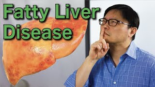 How to Reverse Fatty Liver Disease Naturally  Jason Fung [upl. by Linder291]