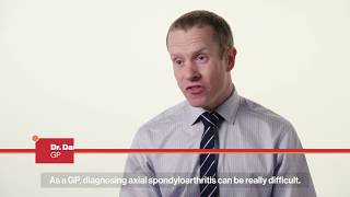 Ankylosing Spondylitis axial spondyloarthritis AS Getting your diagnosis [upl. by Deutsch]