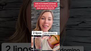 Lipo o abdominiplasticsurgery cirugiaplasticasegura youtubeshorts mujeres cirugiasplasticas [upl. by Ayetal]