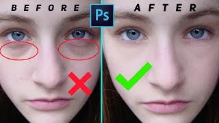 Remove Eye bags and Eye Dark Circle in Photoshop 1minPhotoshop [upl. by Talich]