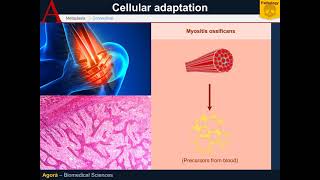 Cellular Pathology  Metaplasia [upl. by Conlen]