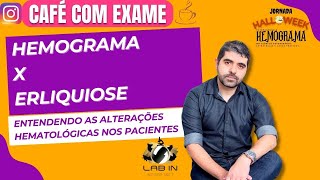 ALTERAÇÕES DA ERLIQUIOSE NO HEMOGRAMA [upl. by Nezah]