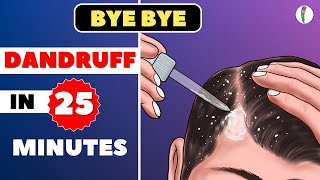 🔥1 Dandruff Treatment at Home  How to get rid of Dandruff  Dandruff Removal  Itchy scalp [upl. by Arrimat]