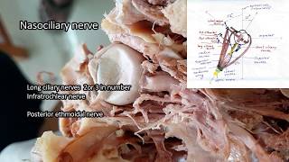 Orbit  dissection  Parts  Relations  Applied Anatomy [upl. by Asyen]