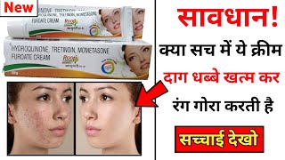 Roop Sundari Gold Cream Review  how to use roop sundari night cream [upl. by Anerat]