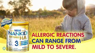 Minimize Your Child’s Risk Of Allergies [upl. by Anaya]