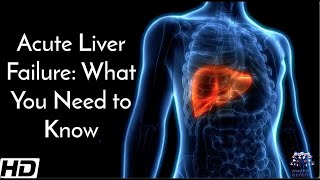 Acute Liver Failure What You Need To Know [upl. by Yleve405]