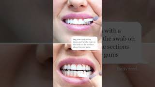 Get CRAZY WHITE Teeth  Best Teeth Whitening Products That Work  Chris Gibson [upl. by Barris499]