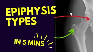 Types of Epiphysis 🦴  In FIVE 5️⃣ Minutes [upl. by Frederigo555]