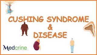 Cushing Syndrome  causes pathophysiology symptoms and treatment [upl. by Paynter]