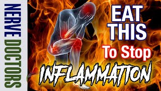 Stop Inflammation with these foods  The Nerve Doctors [upl. by Anayaran844]