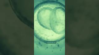 Journey of IVF Embryo Development ivf ivfjourney ivfsuccess [upl. by Sukey41]