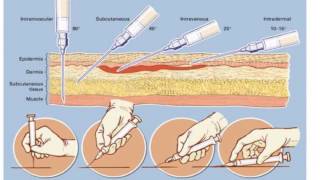 Types of Syringes and Needles  Gwaymedicalcom [upl. by Ryun]