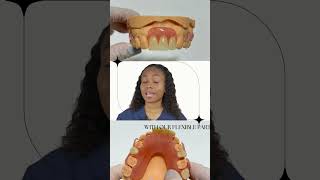 Flexible Partial Dentures for the Front Missing Teeth [upl. by Jordana500]