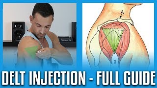 How To Do A Deltoid Injection  Full GuideDemo [upl. by Metsky952]