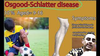 OsgoodSchlatter disease  symptoms causes and treatment [upl. by Lindly]