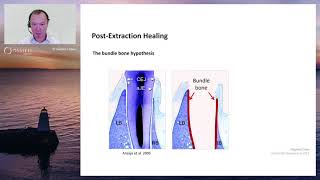 The Bundle Bone Hypothesis [upl. by Rodablas241]