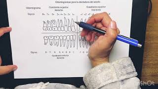 odontograma de signos varinia [upl. by Mandy]