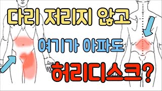 닥터홍선생46다리가 저리지 않아도 허리디스크방사통연관통허리디스크 [upl. by Aserat]