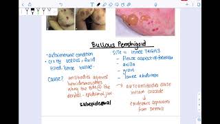 Bullous pemphigoid vs Pemphigus vulgaris [upl. by Evangelia92]