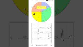 Cardiac axis trainer [upl. by Adnarram]