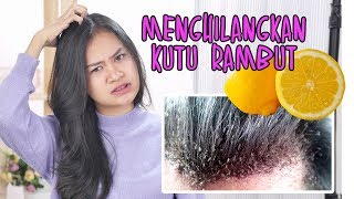 Dijamin Kutu Rambut Hilang Ini Cara Menghilangkan Kutu Rambut Dengan Alami [upl. by Zeb]