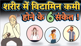 शरीर में विटामिन कम होने के 6 संकेत  6 Signs of Vitamin Deficiency [upl. by Aronoh]