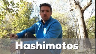 I Have Hashimotos Auto Immune Disease  How I Manage It [upl. by Jacquet728]