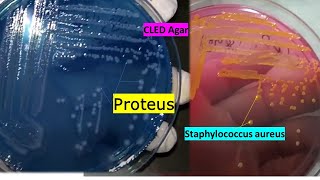 Proteus and Staphylococcus growth on CLED agar Demonstration [upl. by Chubb]