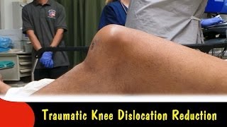 Traumatic Knee Dislocation ReductionQuick Version [upl. by Domela]