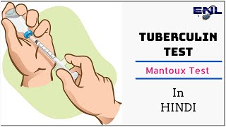 Mantoux Test  Tuberculin Skin Test in Hindi  Easy Explanation [upl. by Karilla]