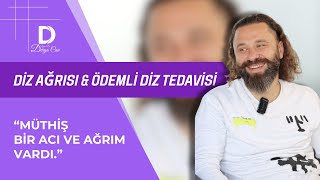 💡 Diz Ağrısı amp Ödemli Diz Tedavisi ➡️ Prolozon Tedavisi [upl. by Schertz]