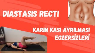 Diastasis Recti  Düzeltici egzersizler [upl. by Flori]