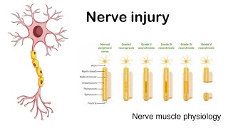 Nerve injury  Sedon and Sunderland classification of nerve injury [upl. by Yramesor]