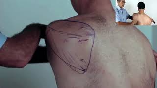 Trigger Point Master Class  How to Release Infraspinatus [upl. by Norton]