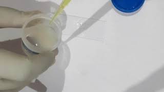 Semen Analysis in Hindi  Semen Test  Semen Test Report  Sperm Count पुरूष वीर्य जांच LABOeXPERT [upl. by Lemor]