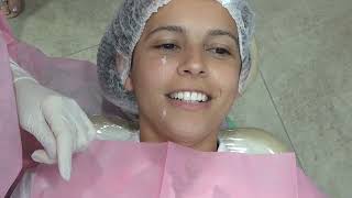 preenchimento labial com cânula [upl. by Artemed]