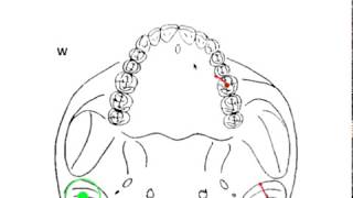 DYNAMIC OCCLUSION  Working vs Nonworking Movement amp Occlusal Grid [upl. by Nadbus158]