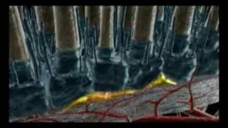 Photodynamic Therapy for Agerelated Macular Degeneration [upl. by Eiknarf934]