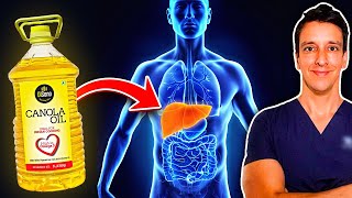 What CANOLA OIL does to your LIVER Influencers wont show you this [upl. by Enalda896]