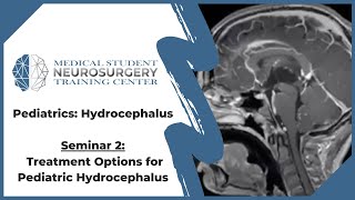 Pediatric Hydrocephalus Seminar 2 Treatment Options for Pediatric Hydrocephalus [upl. by Nalac]