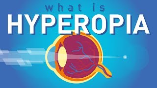 What is Hyperopia Farsightedness [upl. by Tnilf]