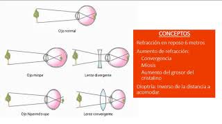 EUNACOM UPV  Oftalmología [upl. by Sadler]