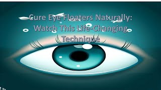 Cure Eye Floaters Naturally Watch This LifeChanging Technique [upl. by Fablan508]