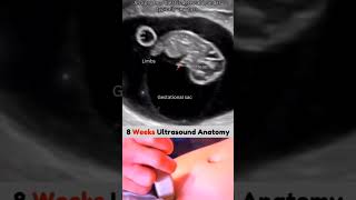 8 week ultrasound baby pregnant women viralshort love life [upl. by Fax]