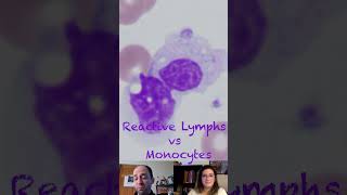 Reactive Lymphocytes versus Monocytes [upl. by Eehsar]