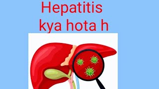 hepatitis bhepatitis chepatitishepatitis aviral hepatitishepatitis b treatment [upl. by Roda]