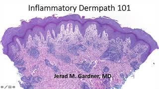 Inflammatory Dermpath 101 A Beginners Guide to Diagnosing Skin Rashes for NonDermatopathologists [upl. by Canale435]