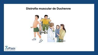 Distrofia muscular de Duchenne [upl. by Eetnwahs]