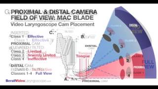 Intro to Video Laryngoscopy [upl. by Yelsnia]